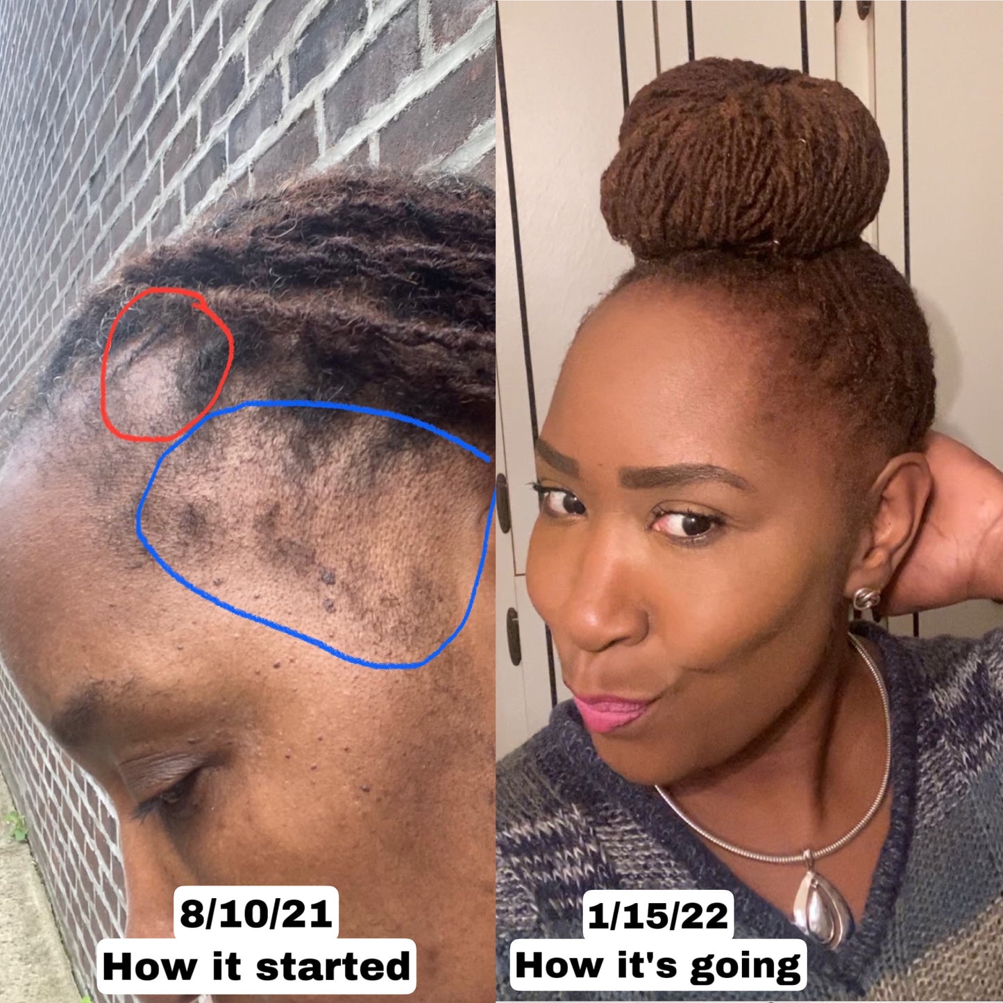 Jatamansi Hair Growth Oil