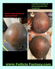 Load image into Gallery viewer, Jatamansi Hair Growth Oil