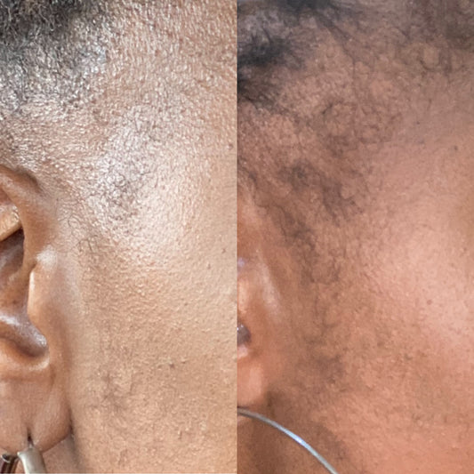 Jatamansi Hair Growth Oil
