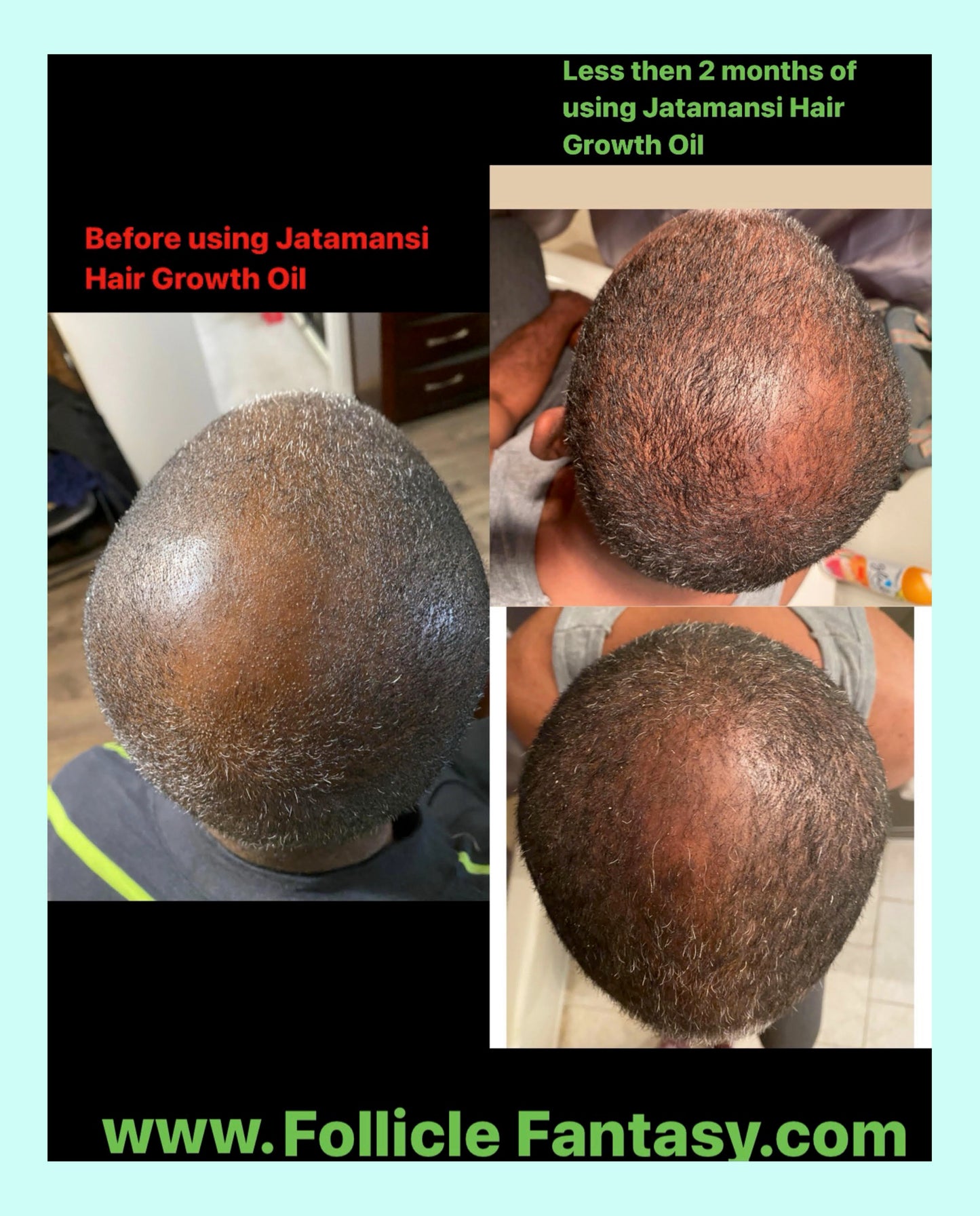Jatamansi Hair Growth Oil